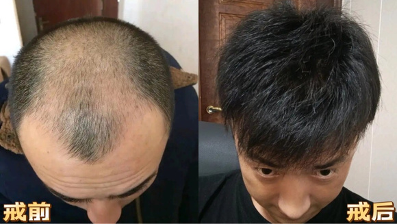 ”戒色一年,头发恢复了