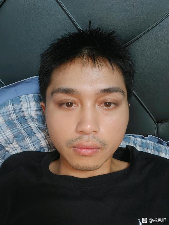 ”有点掉发了。