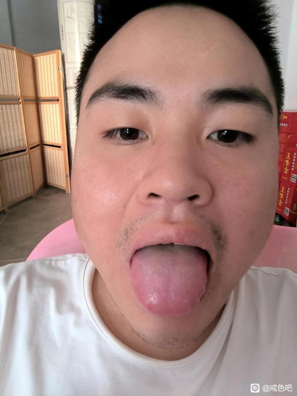 ”手艺活导致神经症