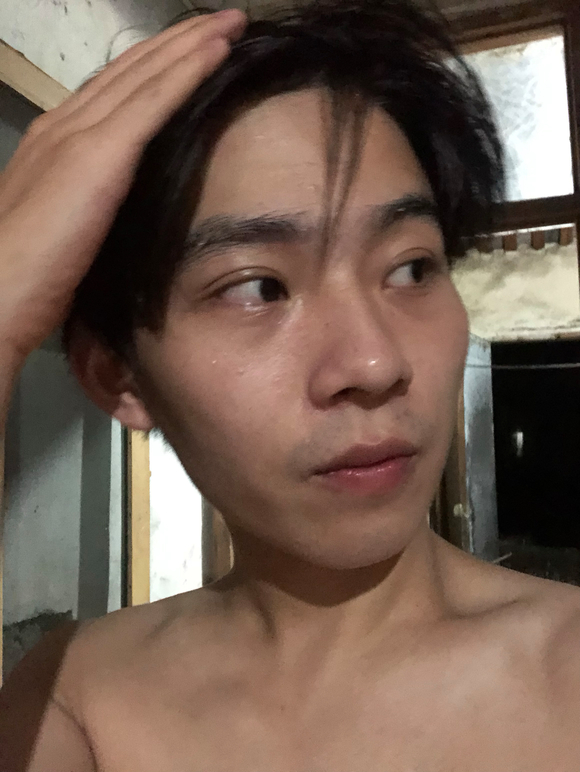 ”伤的严重不兄弟们