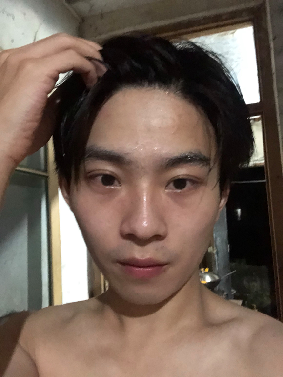 ”伤的严重不兄弟们