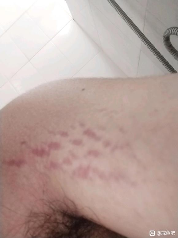 ”这是什么病？打算国庆去看看