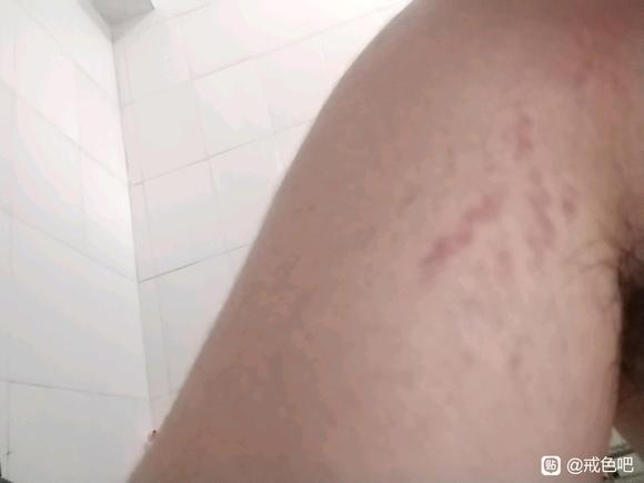 ”这是什么病？打算国庆去看看