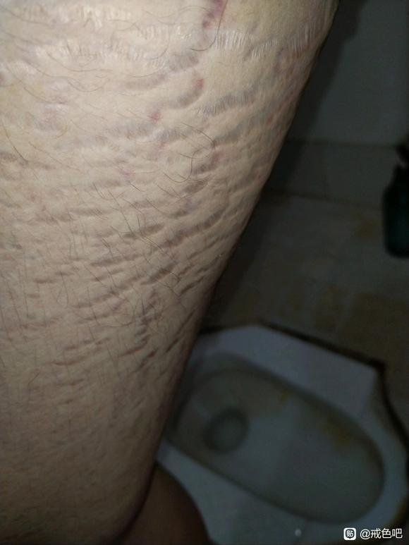 ”这是什么病？打算国庆去看看