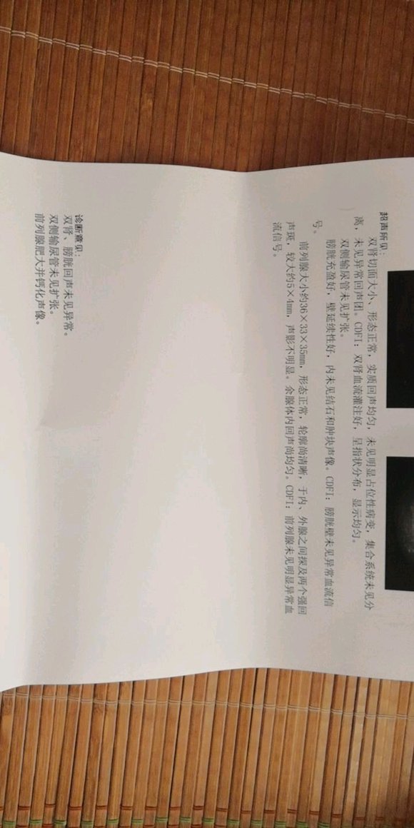 ”今天检查前列腺肥大及钙化，这个情况严重么，已经戒色快一年了