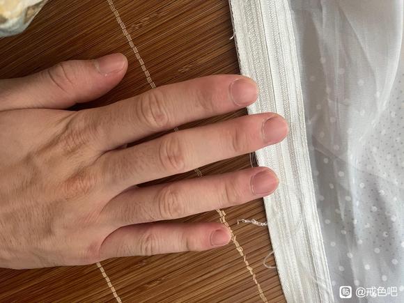 ”月牙只有大拇指有一点，其它都没