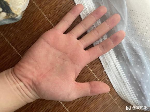 ”月牙只有大拇指有一点，其它都没