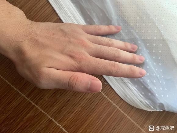 ”月牙只有大拇指有一点，其它都没