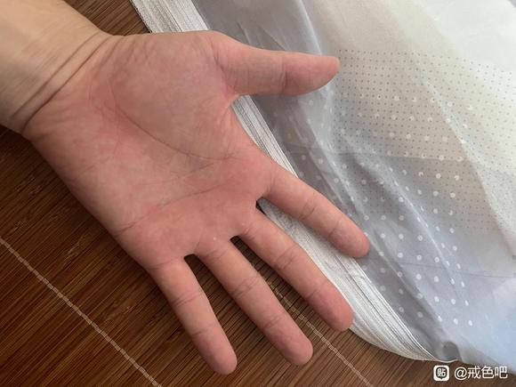 ”月牙只有大拇指有一点，其它都没