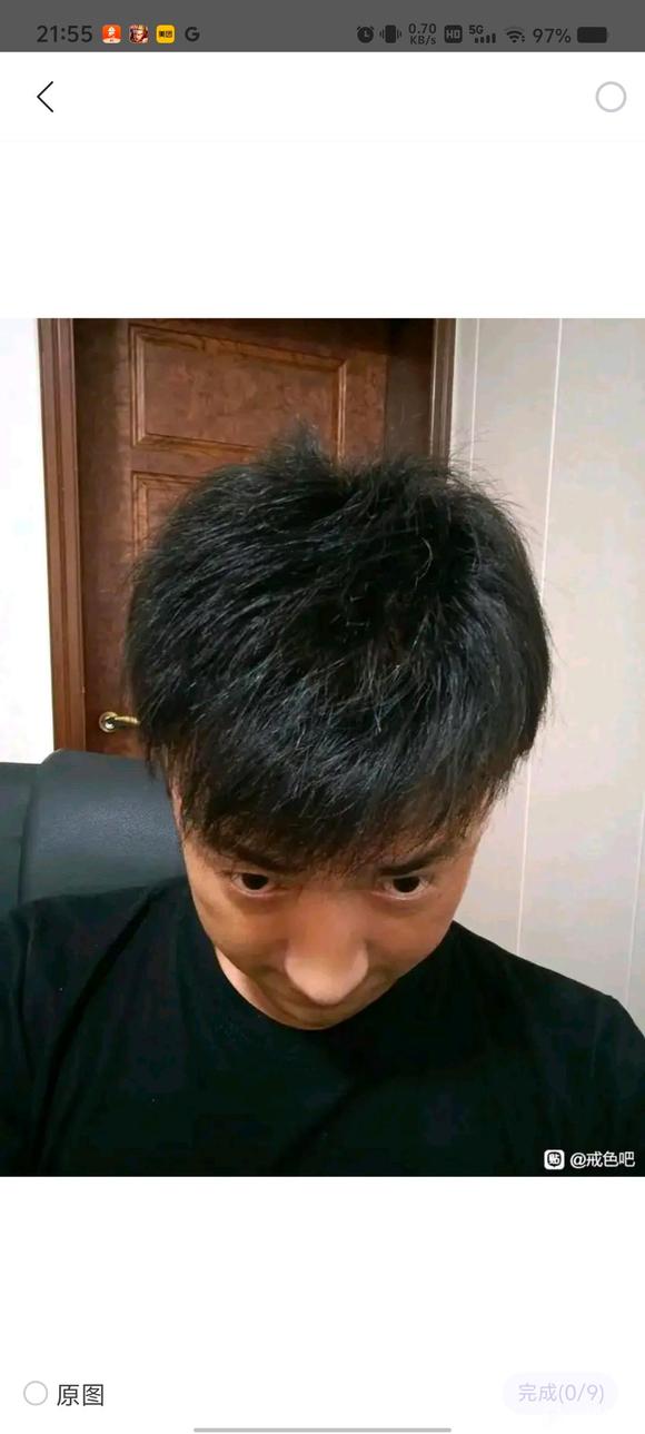 ”脱发问题求助