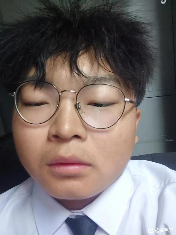 ”眼睛为什么睁不开了