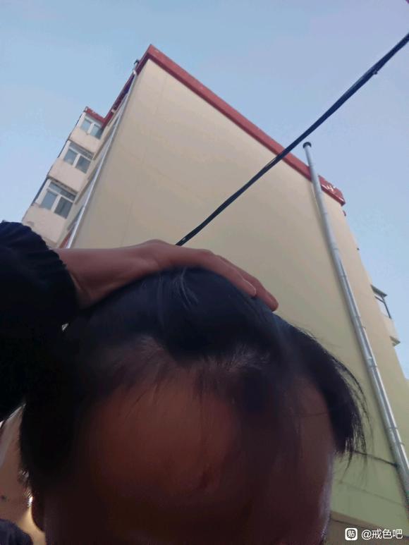 ”16岁头发成这样有希望恢复吗