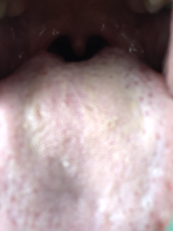 ”金匮肾气丸能吃吗？