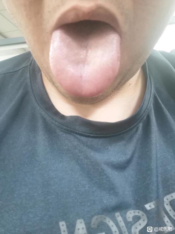 ”我这舌头是什么情况