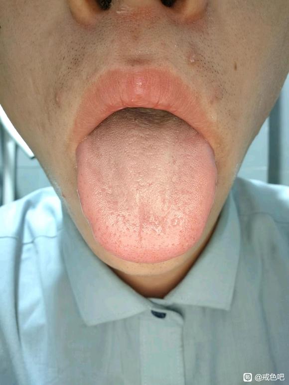 ”频繁遗精怎么减少