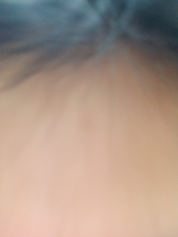 ”新戒友之痘痘疑问