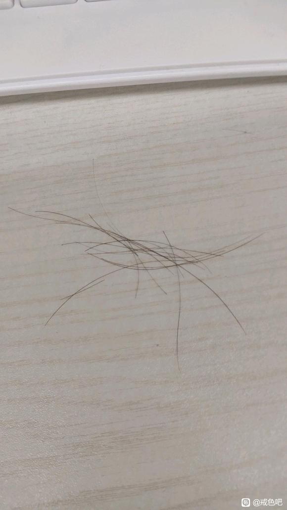 ”我这是不是有点脱发，头发一抓就掉几根，怎么办，有点焦虑了