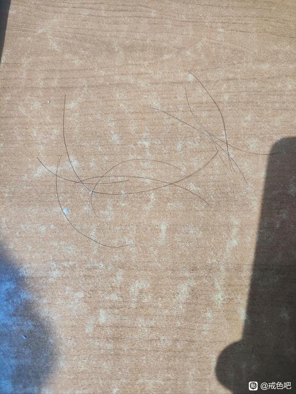 ”我这是不是有点脱发，头发一抓就掉几根，怎么办，有点焦虑了