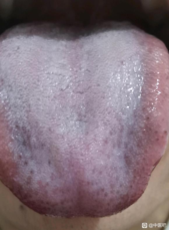 ”【发帖先看置顶】能给我看一下,戒色几年了还是会遗精。