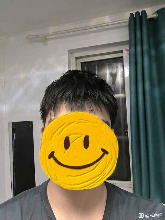 ”求各位老哥指教一下，我这种头发脱发戒色能恢复吗