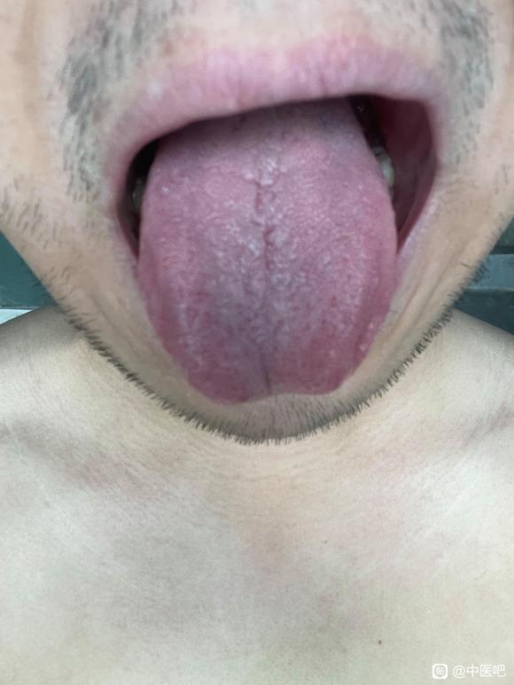 ”【发帖先看置顶】求助，24岁，初中染上手淫恶习