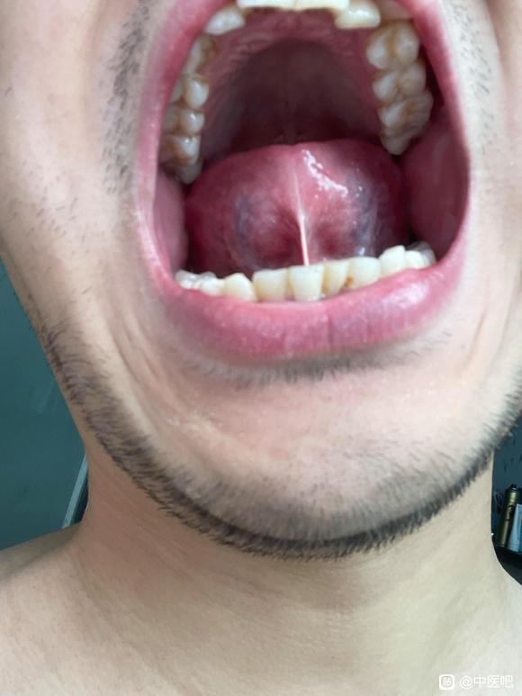 ”【发帖先看置顶】求助，24岁，初中染上手淫恶习