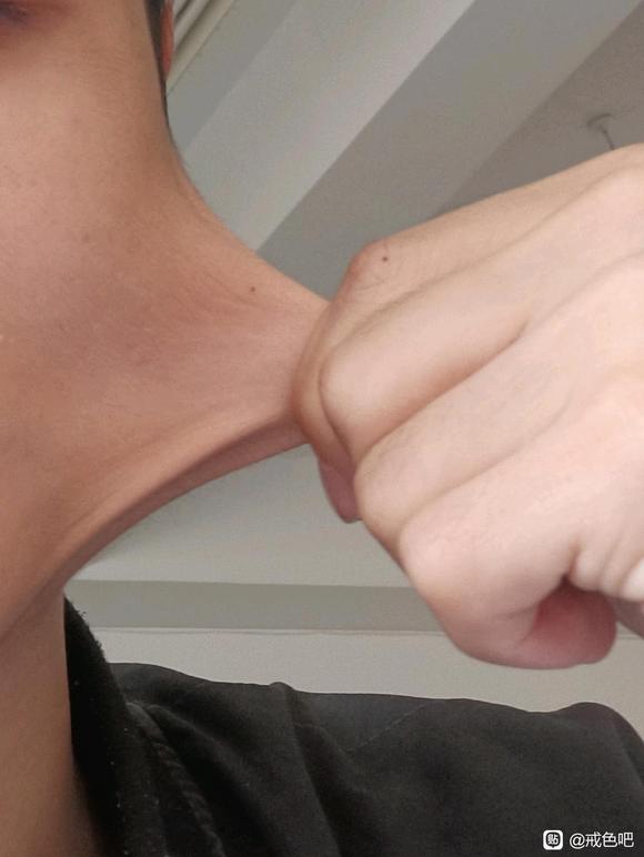 ”8u们，这个脸皮这个样子还有救吗