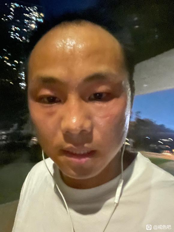 ”运动多久头发能长回来。