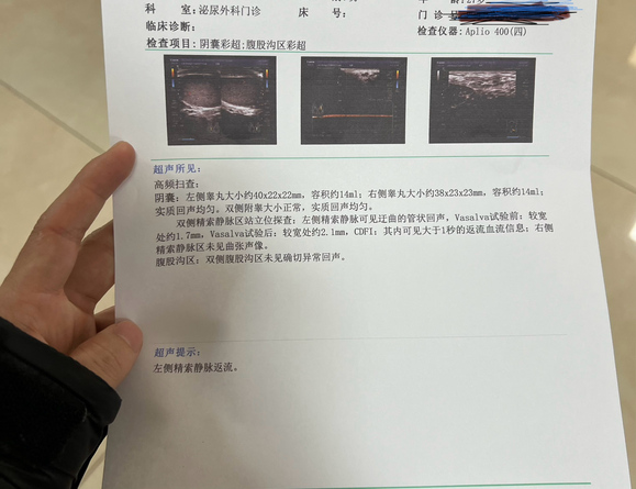 ”今天刚做的彩超，精索静脉血张