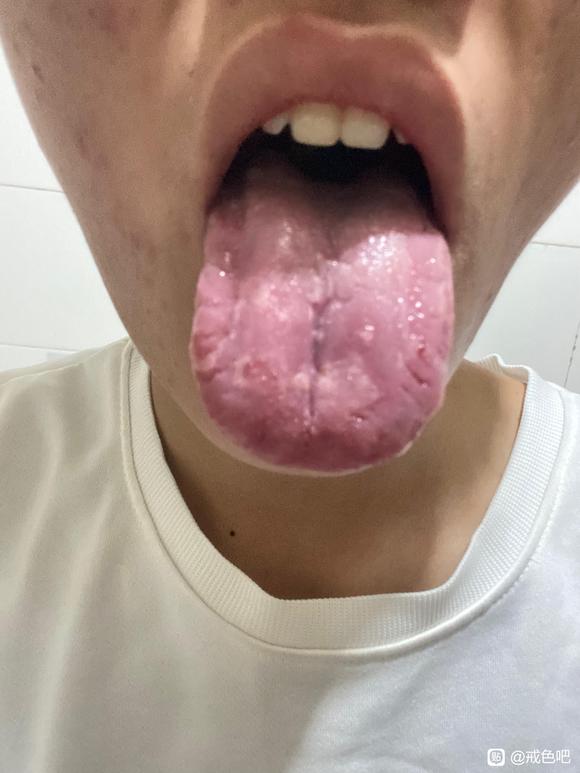 ”怎么办啊师兄们