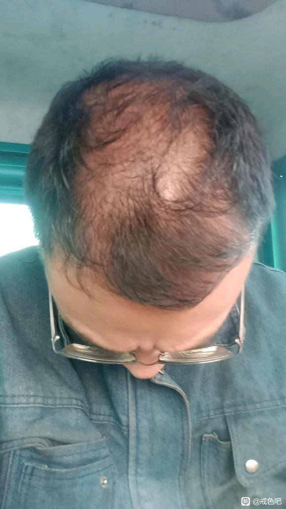 ”今年才28岁天天撸怕是废了