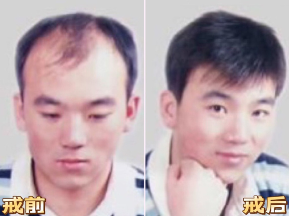”戒色一年，头发长回来