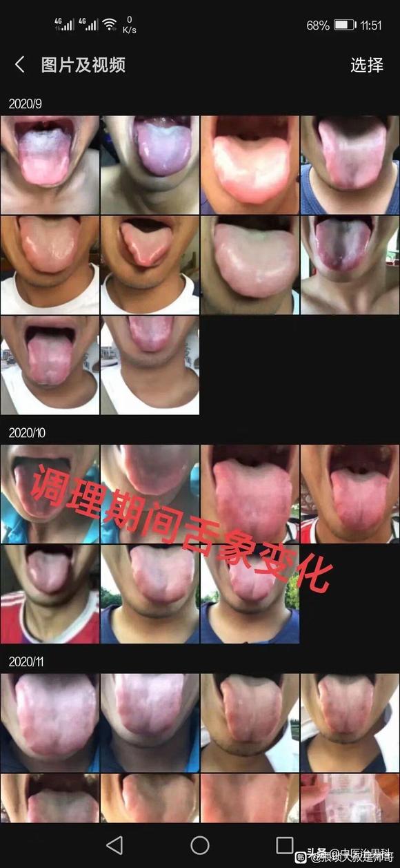 ”肾虚不能乱吃药，一定要找专业#中医##戒色#中医治疗