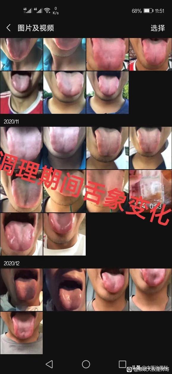”肾虚不能乱吃药，一定要找专业#中医##戒色#中医治疗
