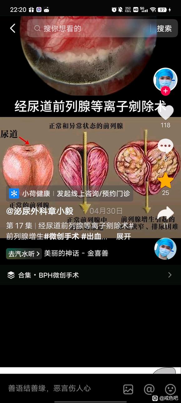 ”多年前列腺患者的治愈之路，和重要的经验。#阳痿##尿频#