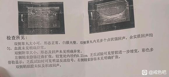 ”戒手淫，记录精索能否自愈