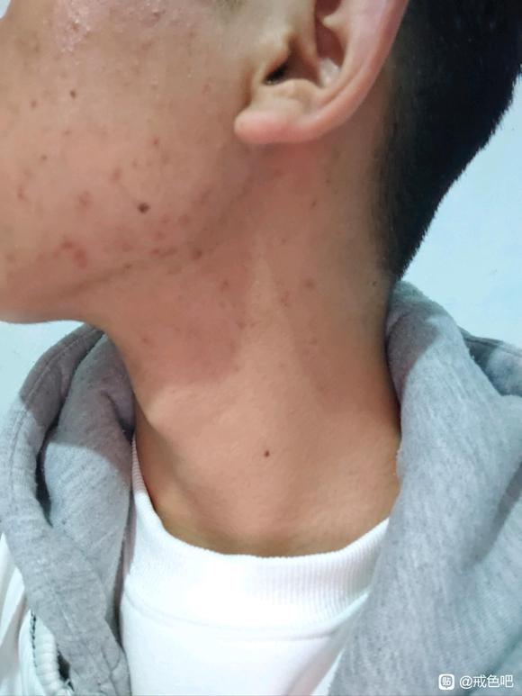 ”皮肤好差劲