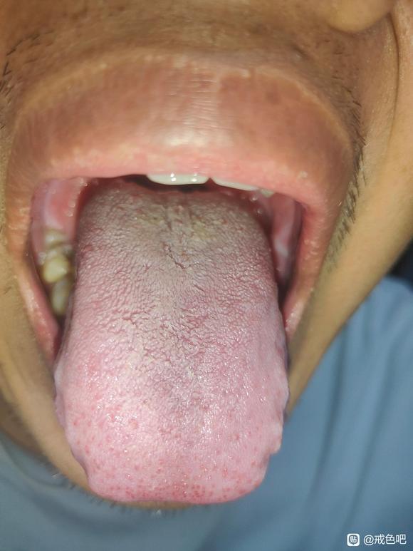 ”有懂的友友可以帮帮看看吗