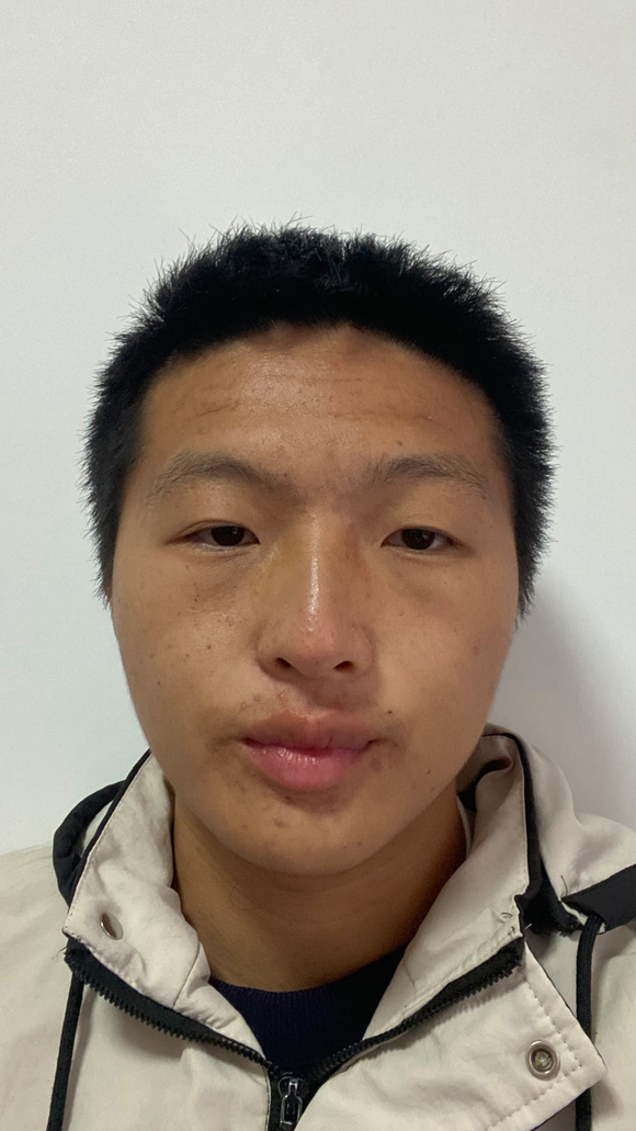 ”前辈们问个事，撸成这样要多久才能恢复？