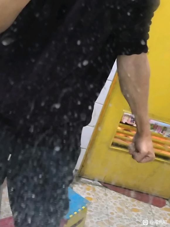”受伤了手臂凹进去一块