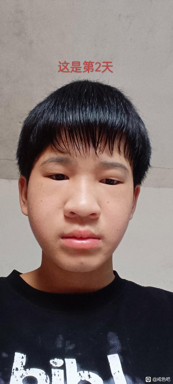 ”前辈们怎样恢复的快