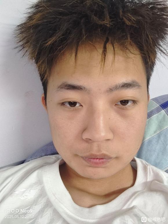”师兄们，我还能恢复面部骨骼吗，好想哭