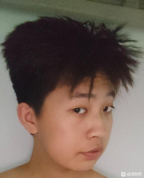 ”师兄们，我还能恢复面部骨骼吗，好想哭