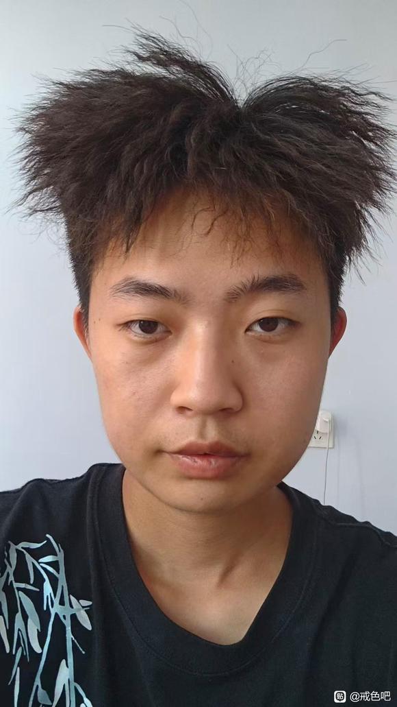 ”师兄们，我还能恢复面部骨骼吗，好想哭