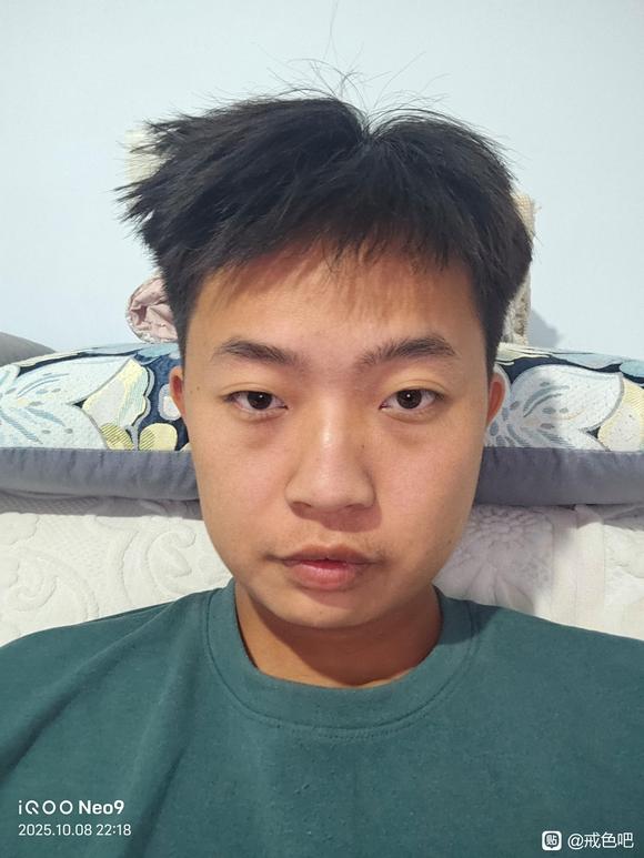 ”师兄们，我还能恢复面部骨骼吗，好想哭