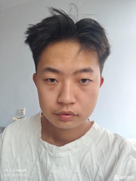 ”师兄们，我还能恢复面部骨骼吗，好想哭
