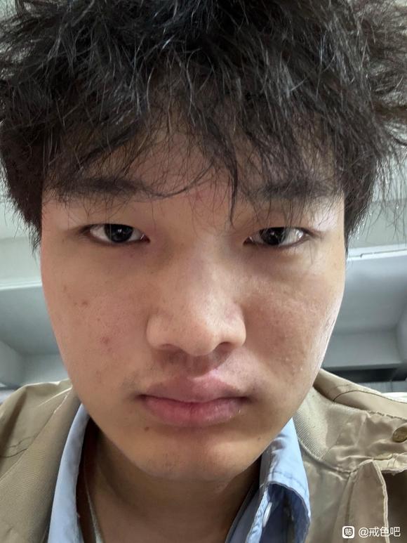 ”【邪淫危害】怎么恢复成好的皮肤状态？？？求求求！！！