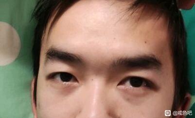 ”戒色41天前后变化图