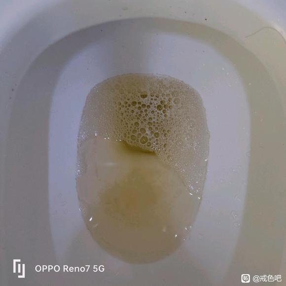 ”戒了三天，有泡沫尿