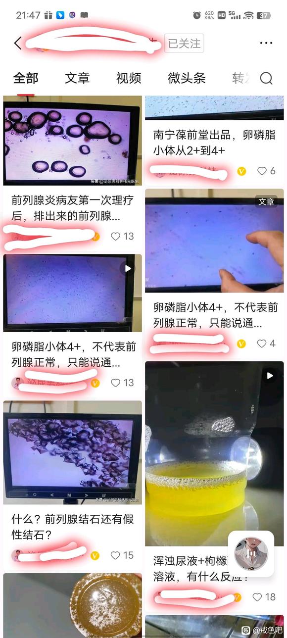 ”多年前列腺患者康复之路，和重要的宝贵经验